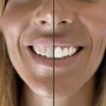 Wellys-x000000ae-GI-021300-Set-de-blanchiment-des-dents-3.jpg